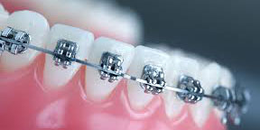 Orthodontics
